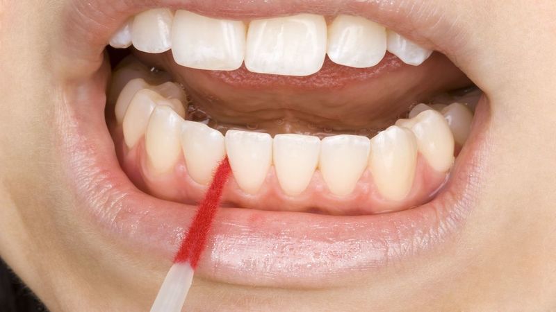 See Your Dentist for Gum Disease Treatments in Moorhead, MN