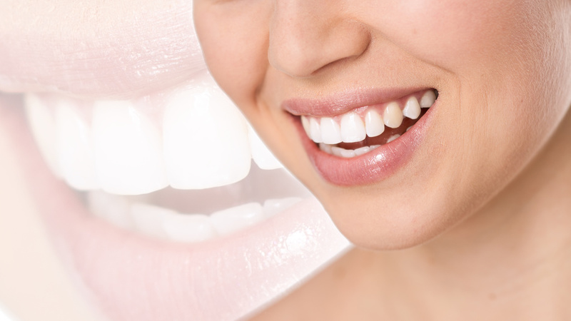 5 Reasons Why A Tooth Implant In Vancouver WA Is The Best Solution For Tooth Loss
