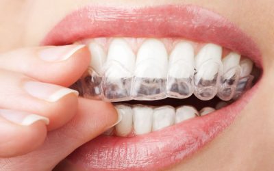 How an Orthodontist in Chanhassen, MN Can Help Teens Achieve a Confident Smile Faster